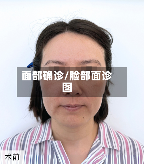 面部确诊/脸部面诊图