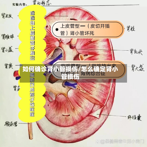 如何确诊肾小管损伤/怎么确定肾小管损伤